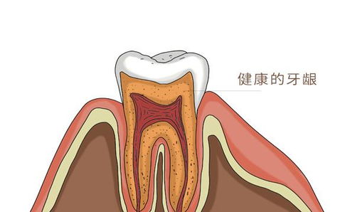 牙龈出血是肝脏有问题了吗？