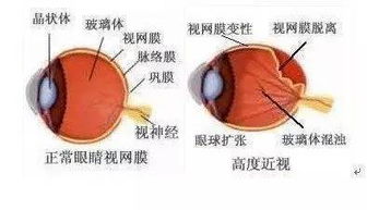 碱性磷酸酶偏高