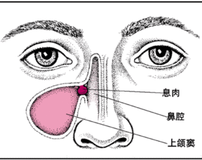 流清鼻涕，有可能是鼻炎吗