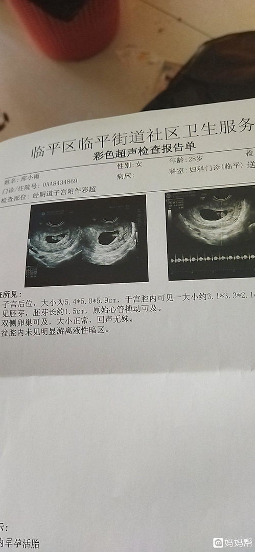 怀孕反应能看出生男生女吗