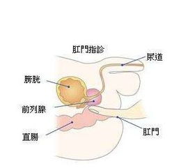 做了宫腔镜检查后多久可以同房