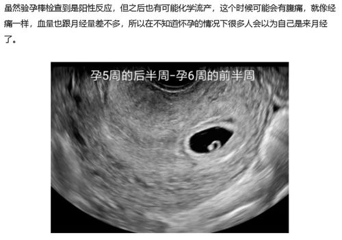 做了宫腔镜检查后多久可以同房