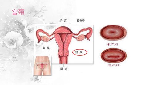 妇科常见疾病指的是什么病