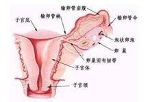 慢性盆腔炎是什么原因引起来的