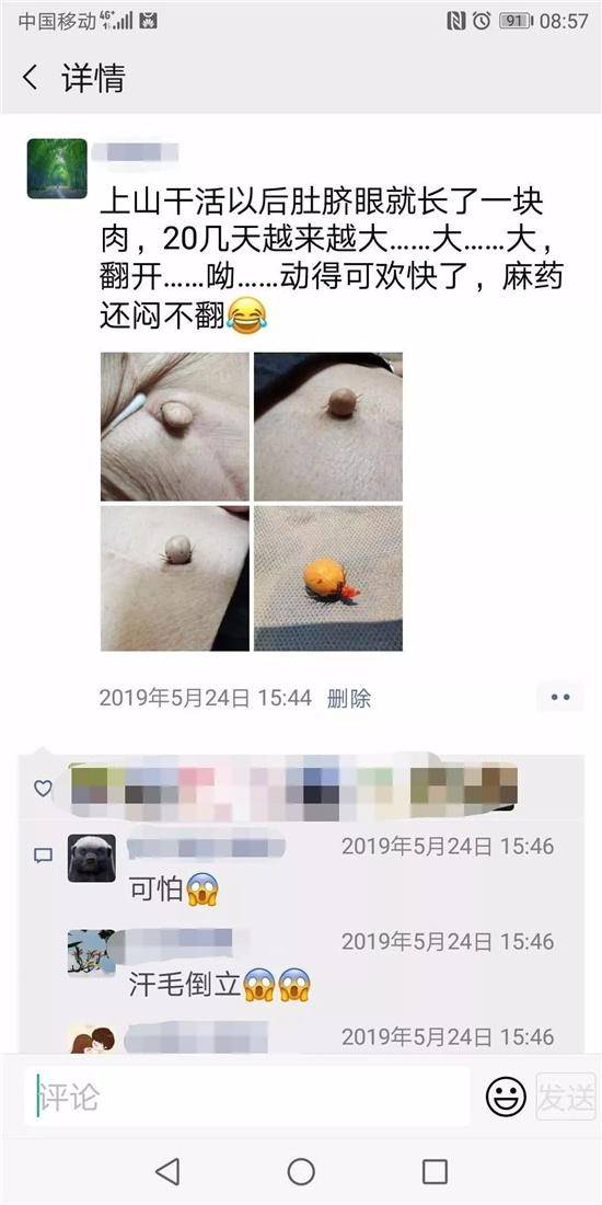 我的女朋友为什么从肚脐眼到私处有一条很明显的线？