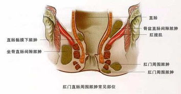 怀孕33周胎儿后颅窝值有异常