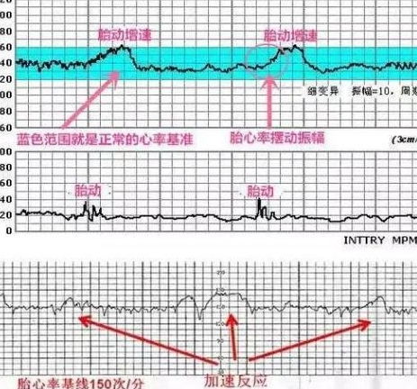 36周左右的麻麻们胎动大概都什么频率？