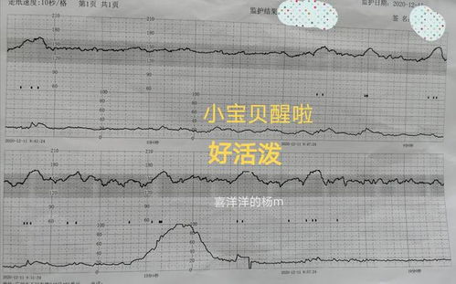 36周左右的麻麻们胎动大概都什么频率？