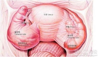 输卵管炎会导致腰疼吗