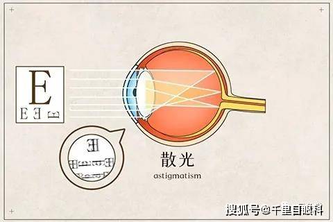 50度散光算严重吗