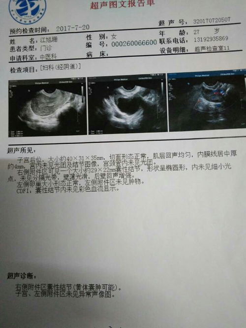 及大小约1.3·1.2cm的卵泡回声，什么时候排卵