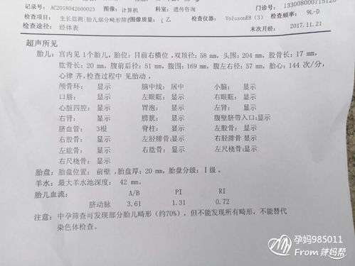 孕12周羊水深度正常值2.7