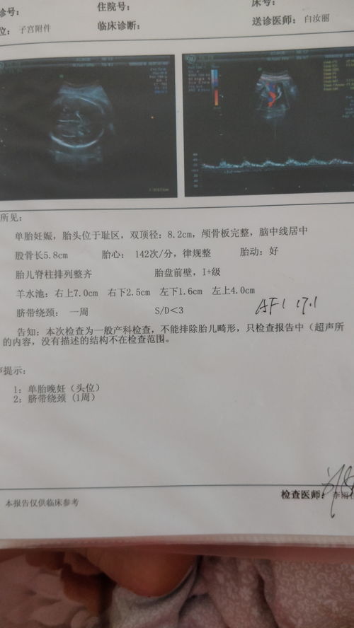 怀孕24周股骨长正常值是多少cm