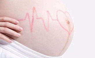 正常胎儿胎心率多少算正常范围