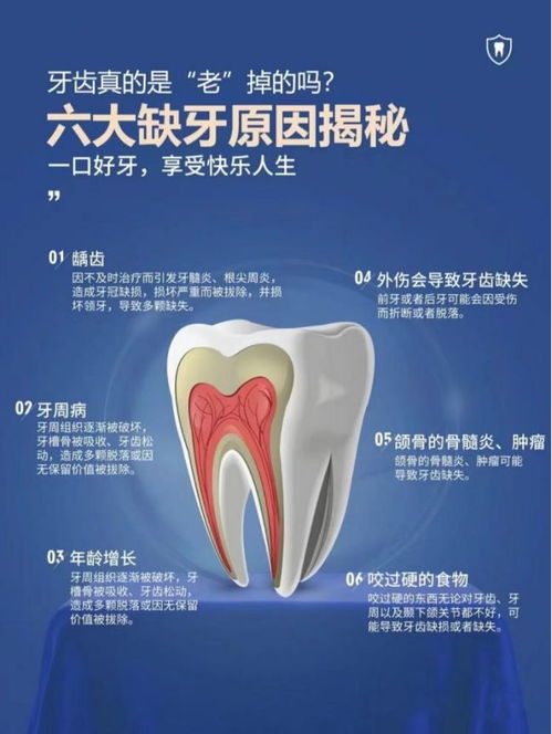 种植牙可以医保报销吗？