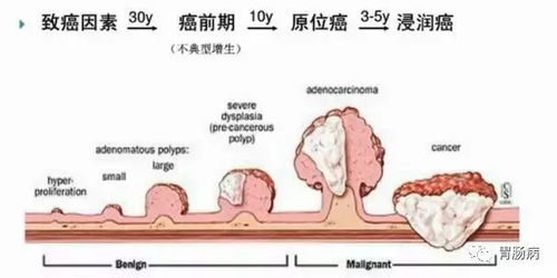 子宫全切的手术步骤