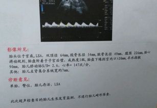 一定要做足的9项孕检项目吗