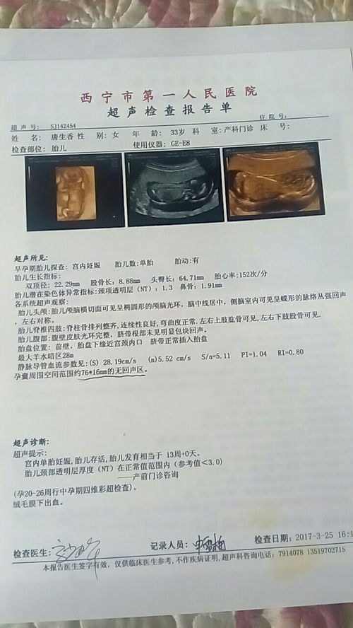 怀孕有深褐色分泌物流出