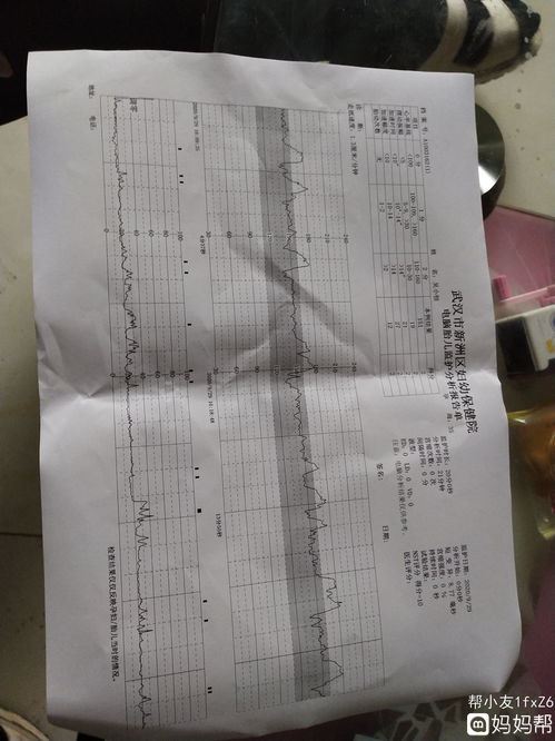 胎儿胎心监护不过关的原因