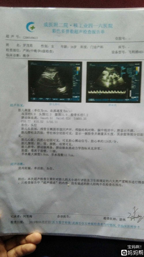 怀孕38周胎儿大小标准