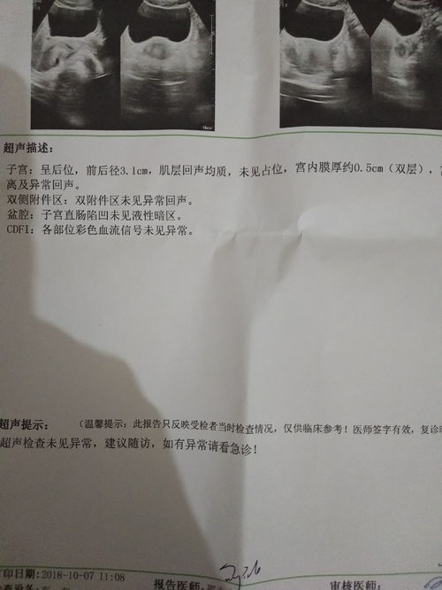 生化妊娠后hcg多久恢复正常值