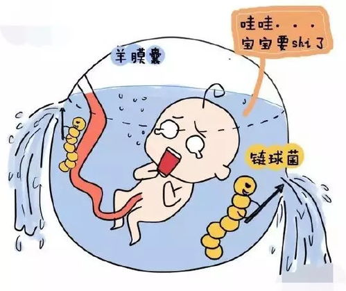 胎膜早破如何应对胎儿