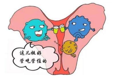 女性盆腔粘连是什么意思