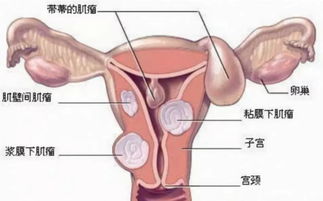 女性宫寒会不孕吗