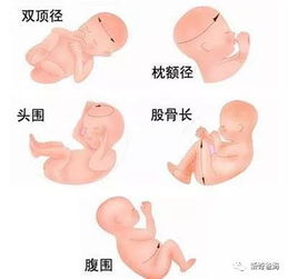 腹部大小是否正常?孕妈妈们知道吗图片