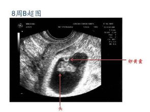 怎么样从b超单看出胎儿性别