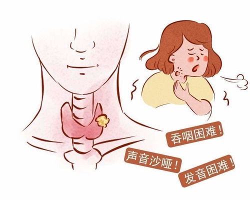 甲状腺高属于高危产妇么