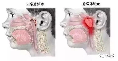 感冒不知是风寒还是风热