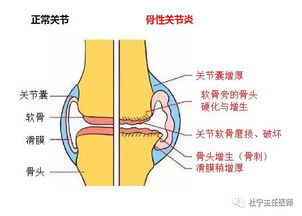 为什么膝胸卧位可以矫正胎位不正或子宫后倾？