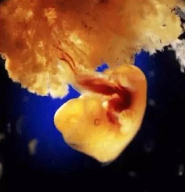 怀孕9周左右的胚胎有多大