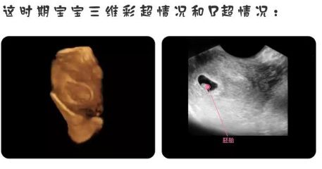 怀孕5周死胎有什么症状