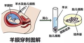 判断生男生女最准确的方法