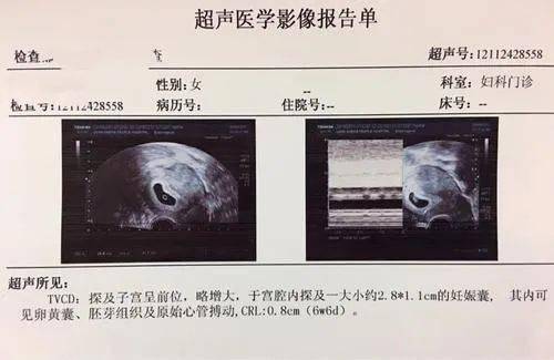 二个月10天妊娠囊数据6.2,2.7怎么相差这么多