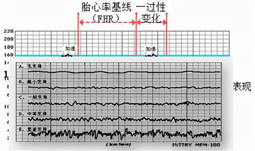 胎儿胎心率快是怎么回事?急