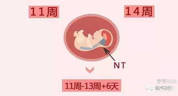 怀孕12周需做哪些检查