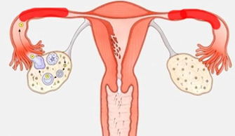 女性输卵管堵塞了怎么弄