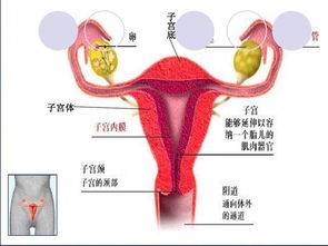 输卵管堵塞输不通怎么办