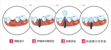 极限运算法则在什么情况下不能用