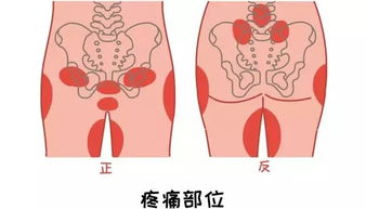 怀孕多少周耻骨开始疼