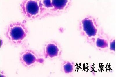 女性解脲支原体感染有什么症状