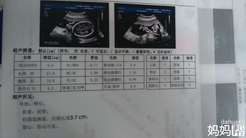 怀孕6周能看出男女吗图片