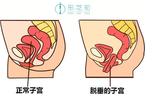 不知道怀孕了一直在节食