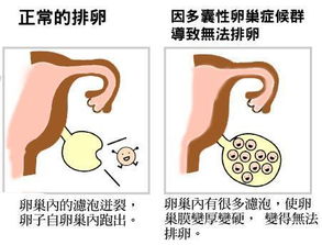 卵泡多大排出？