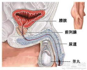 附睾炎可以拔罐吗