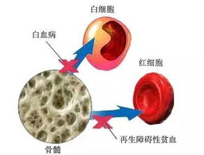 怀孕了红细胞压积偏低是怎么回事