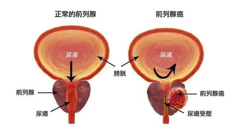 卵黄囊会一直长大吗?